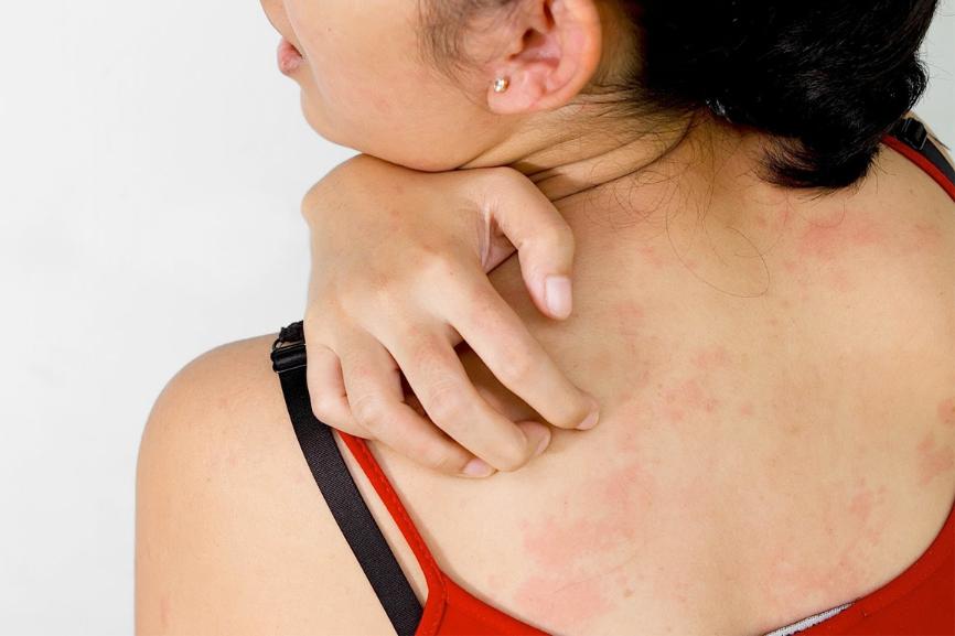 4-10 сентября - Неделя профилактики кожных заболеваний